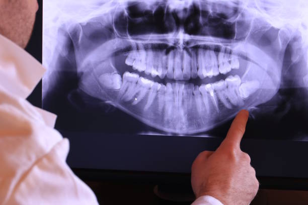 Best Emergency Treatment for Dental Infections or Abscesses in South Hill, VA