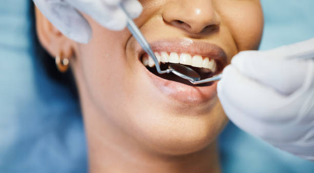 Best Emergency Treatment for Dental Infections or Abscesses in South Hill, VA